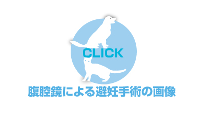 避妊手術